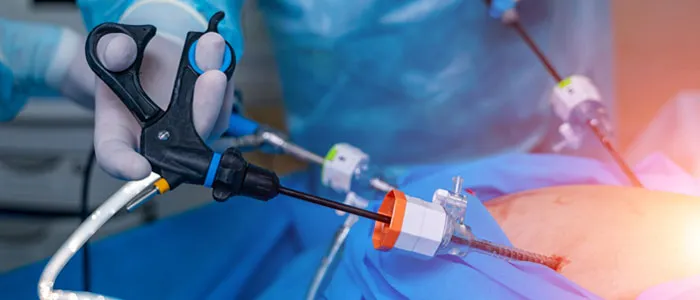 Endoscopy procedure