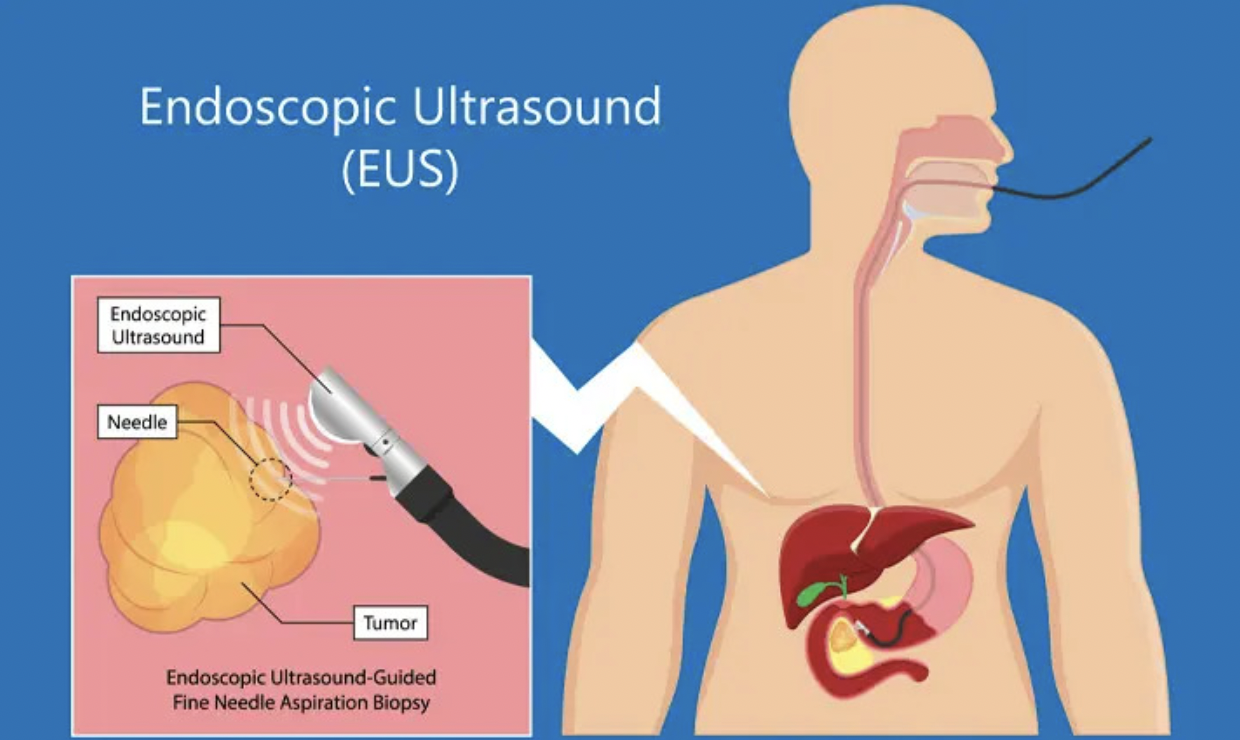 EUS Graphic